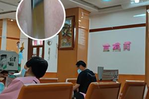 他克莫司软膏能长期用吗