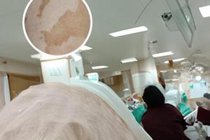 小孩儿脸上白斑要吃什么药好