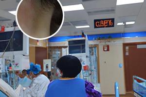 小孩脸上长白斑什么原因图片