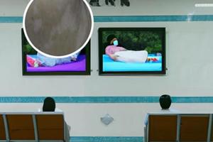 他克莫司胶囊为什么医院不愿多开