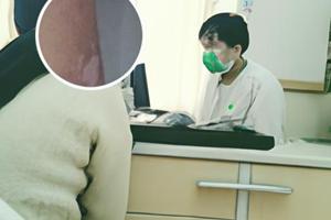 擦他克莫司软膏身上瘙痒还能继续擦吗