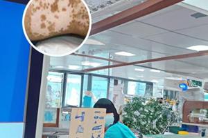 肝素钠乳膏白点可以用吗