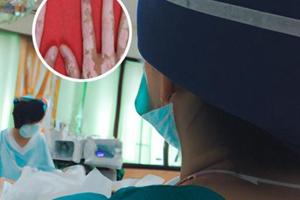 眼睑白癜风可以擦他克莫司吗