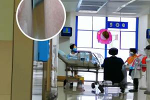 小孩白斑怎么回事图片大全