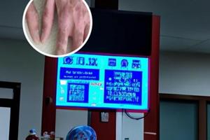 白斑怎么治才能根除白电风和黑色素一样吗