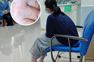 小孩子白斑多久消失