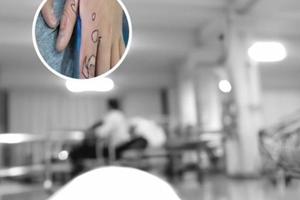 白癜风照308激光照3个月能治好吗为什么