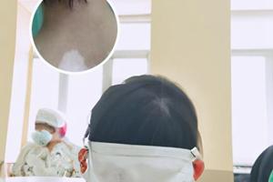 白殿风患者可以喝地锦草泡水喝吗