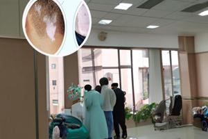 卤米松乳膏主治什么皮肤病