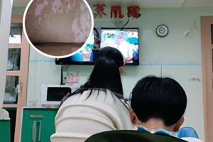 308白癜风治疗次数是多少