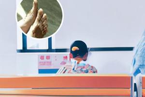 小儿胳膊上有白斑图片和症状图片