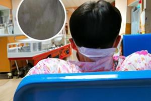 小孩点状白斑是什么病的前兆