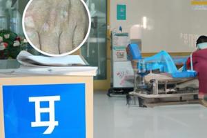 下嘴唇内有白斑是怎么回事儿吃什么药
