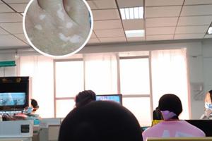 小孩患了白斑怎么办呢图片大全