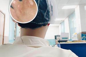 晕痣治疗方法百度百科女性
