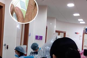 他克莫司软膏含什么成分