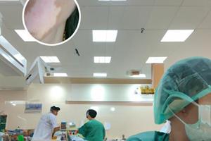 308准激光治疗中断后续会怎样