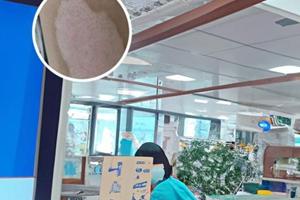 卡泊三醇擦剂怎么涂抹