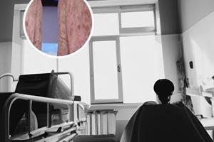 怎样看懂皮肤镜报告单
