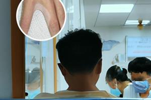 泼尼松片属于什么药
