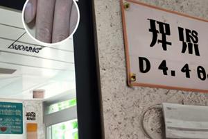 治疗晕痣需要多少钱一次