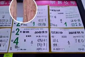 皮肤ct扫描脑部白斑块严重吗怎么治疗