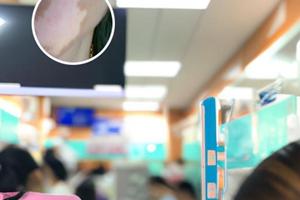 他克莫司软膏涂了有烧灼感