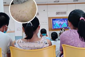 白癜风纹眉有影响吗