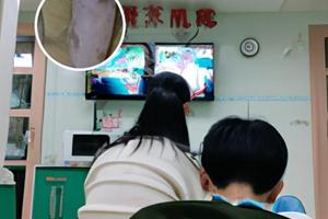白癜风银屑病会遗传吗