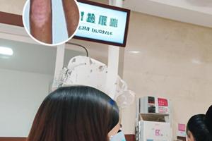 他克莫司软膏怎么用在脸上