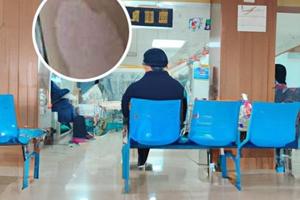 做了308激光碰了水会不会失效
