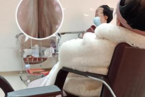 女性色素脱失症都有些什么症状表现