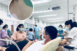 有色素脱失症部位汗毛发白会是色素脱失症病吗
