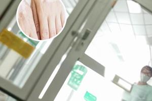 嘴唇内侧有色素减退斑像溃疡很疼怎么办