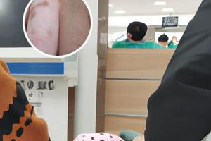 白癜风光疗仪311是真的吗