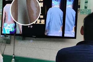 光疗价格高不高的原因