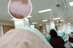 兰州中研白颠疯医院治疗效果如何