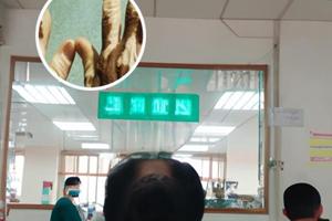 皮肤ct和普通ct有啥区别图片