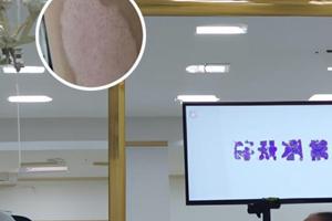 贵州白癜风医院有多大