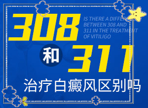 早期的白癫能不能治好和改善的症状是什么