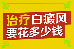 的白癜风是什么症状