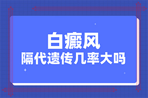 白癜风的诊断可以从何处获得