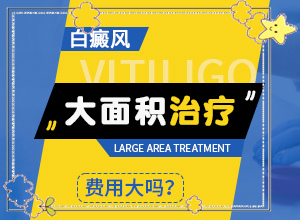 白癜风在患者身上的表现有哪些呢