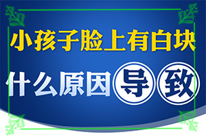 进展期白癜风能否用复方卡利孜然酊治疗