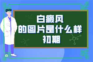 白癜风的症状体现有哪些呢