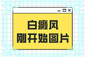 白癜风疾病都有哪些危害