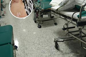 宝宝身上出现白色斑块