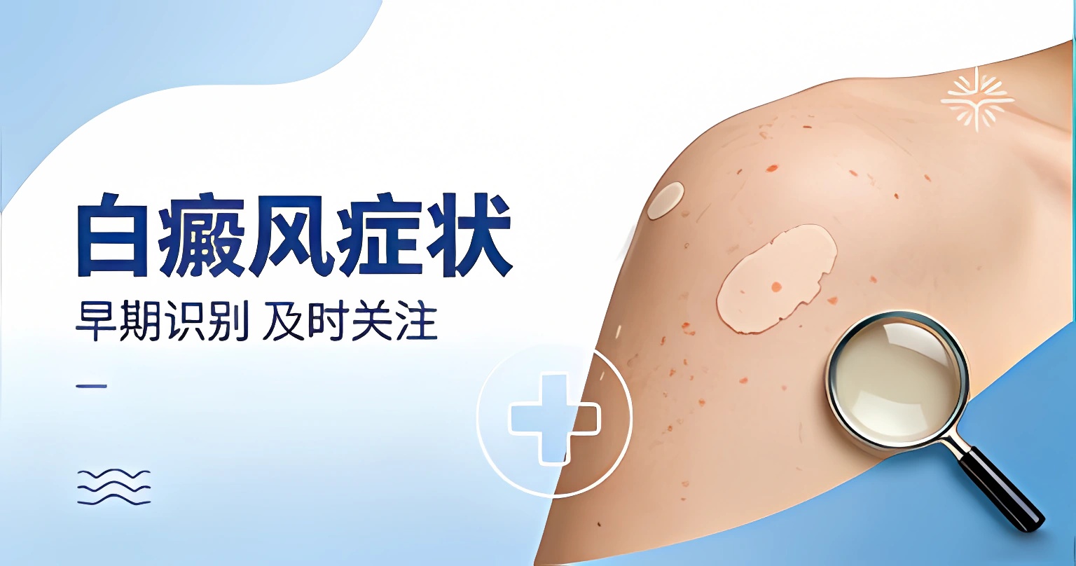 白癜风症状